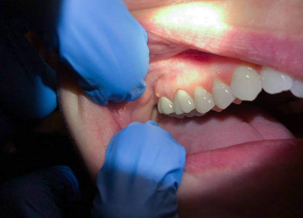 Professional Emergency Dentist in NM